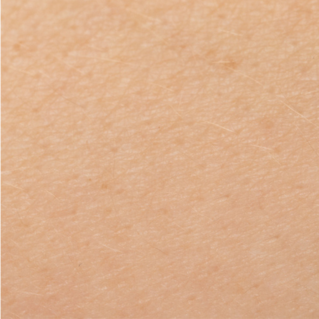 Trockene Gesichtshaut nach der veganen Naturkosmetik Gesichtspflege von Hauchgrün