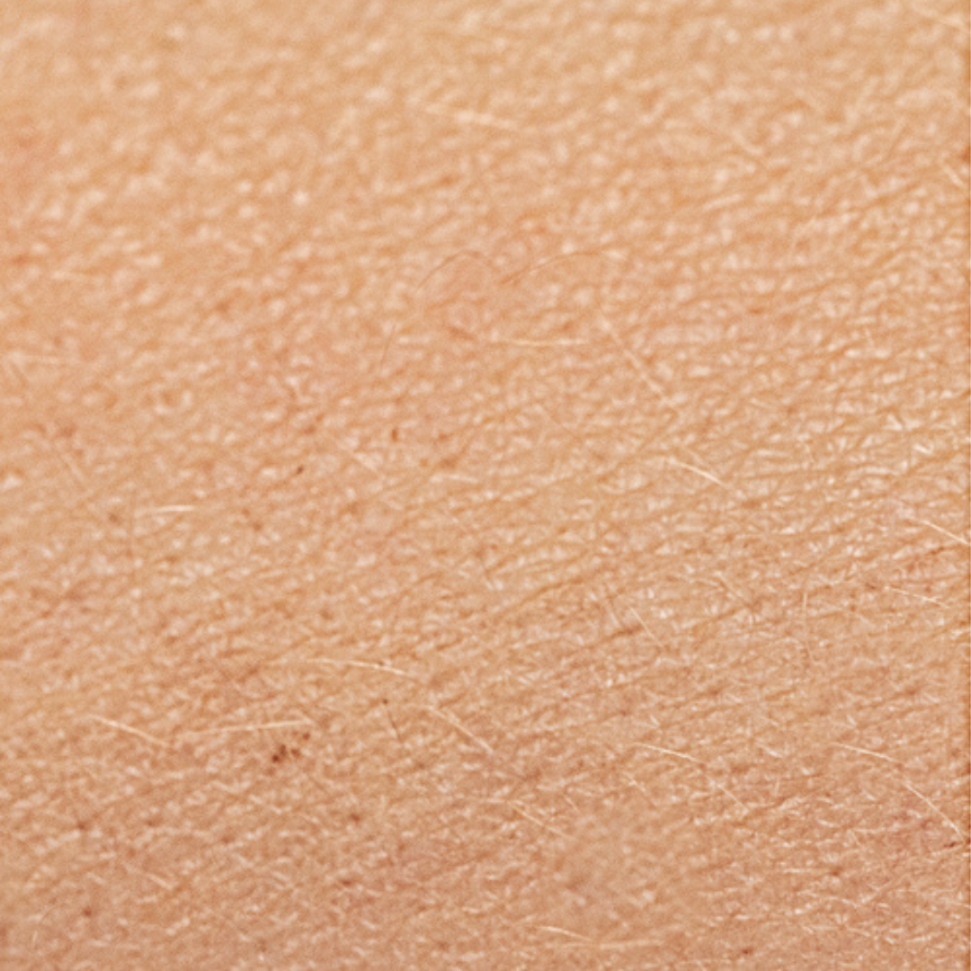 Trockene Gesichtshaut vor der veganen Naturkosmetik Gesichtspflege von Hauchgrün
