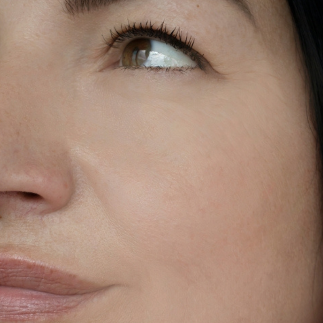 Alternde, reife Haut nach der veganen Naturkosmetik Gesichtspflege von Hauchgrün