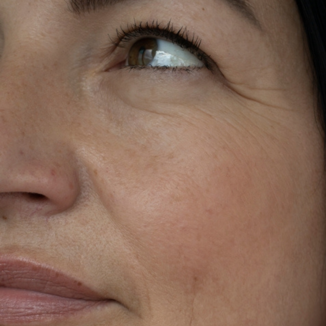Alternde, reife Haut vor der veganen Naturkosmetik Gesichtspflege von Hauchgrün